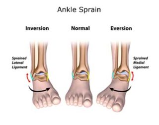 autumn moretti foot injury