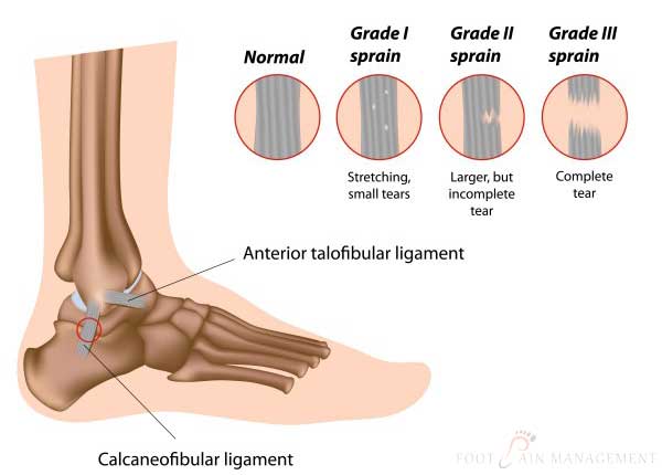 Ankle Problems | Foot Problems